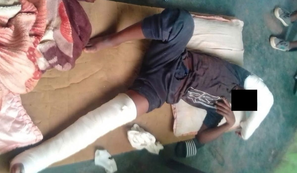 Ngcobo Teen (15) Suffers Broken Limbs in Alleged Attack